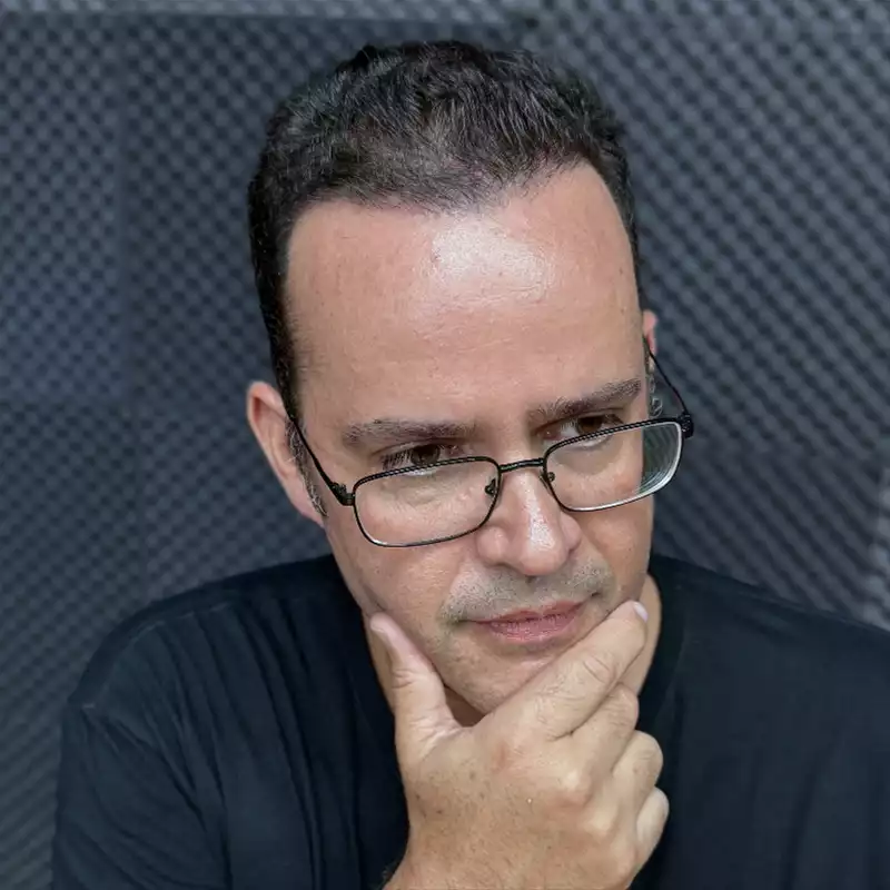 Transplante Capilar na Clínica Cappelli - 4 meses pós transplante do Seu Zine